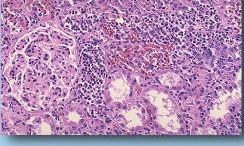 月经期喝冰的会怎样、孕妇用姜泡脚太久可以吗 -孕妇用姜泡脚太久网